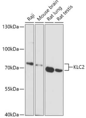 Western Blot: KLC2 Antibody [NBP3-04812] - Analysis of extracts of various cell lines, using KLC2 antibody at 1:1000 dilution. Secondary antibody: HRP Goat Anti-Rabbit IgG (H+L) at 1:10000 dilution. Lysates/proteins: 25ug per lane. Blocking buffer: 3% nonfat dry milk in TBST. Detection: ECL Basic Kit