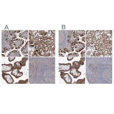 Immunohistochemistry-Paraffin: KLC4 Antibody [NBP1-88772] - Staining of human gastrointestinal, kidney, placenta and tonsil using Anti-KLC4 antibody NBP1-88772 (A) shows similar protein distribution across tissues to independent antibody NBP1-88773 (B).