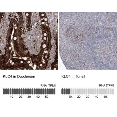 Immunohistochemistry-Paraffin: KLC4 Antibody [NBP1-88773] - Analysis in human duodenum and tonsil tissues using NBP1-88773 antibody. Corresponding KLC4 RNA-seq data are presented for the same tissues.