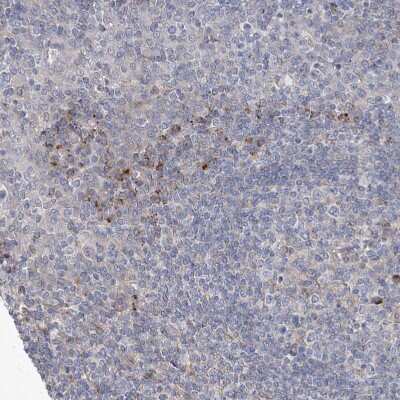 Immunohistochemistry-Paraffin: KLC4 Antibody [NBP1-88773] - Staining of human Tonsil shows very weak cytoplasmic positivity in non-germinal center cells.