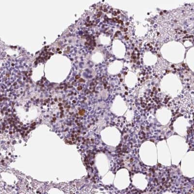 Immunohistochemistry-Paraffin: KLF1 Antibody [NBP2-49023] - Staining of human bone marrow shows high expression.
