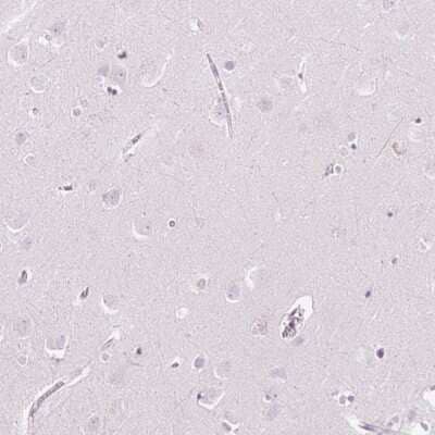 Immunohistochemistry-Paraffin: KLF1 Antibody [NBP2-49023] - Staining of human cerebral cortex shows low expression as expected.