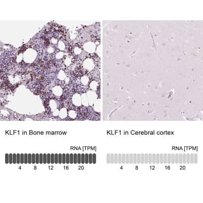 Immunohistochemistry-Paraffin: KLF1 Antibody [NBP2-49023] - Staining in human bone marrow and cerebral cortex tissues using anti-KLF1 antibody. Corresponding KLF1 RNA-seq data are presented for the same tissues.
