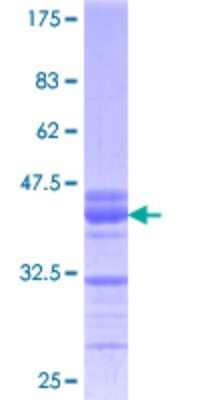 SDS-Page: KLF10 Partial Protein [H00007071-Q01] - 12.5% SDS-PAGE Stained with Coomassie Blue.