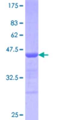 SDS-Page: KLF10 Partial Protein [H00007071-Q02] - 12.5% SDS-PAGE Stained with Coomassie Blue.
