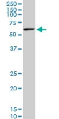 Western Blot: KLF11 Antibody (10C5) [H00008462-M02] - KLF11 monoclonal antibody (M02), clone 10C5. Analysis of KLF11 expression in NIH/3T3.