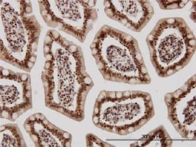 Immunohistochemistry-Paraffin: KLF11 Antibody (8F4) [H00008462-M01] - Analysis of monoclonal antibody to KLF11 on formalin-fixed paraffin-embedded human small Intestine. Antibody concentration 3 ug/ml.