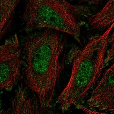 Immunocytochemistry/Immunofluorescence: KLF11 Antibody [NBP2-58081] - Staining of human cell line SiHa shows localization to nucleoplasm & focal adhesion sites.
