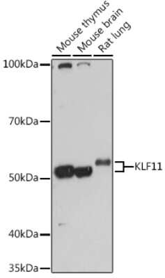 Western Blot: KLF11 Antibody [NBP3-15582] - Western blot analysis of extracts of various cell lines, using KLF11 antibody (NBP3-15582) at 1:1000 dilution. Secondary antibody: HRP Goat Anti-Rabbit IgG (H+L) at 1:10000 dilution. Lysates/proteins: 25ug per lane. Blocking buffer: 3% nonfat dry milk in TBST. Detection: ECL Basic Kit. Exposure time: 10s.