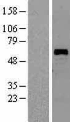 Western Blot: KLF11 Overexpression Lysate (Adult Normal) [NBL1-12314] Left-Empty vector transfected control cell lysate (HEK293 cell lysate); Right -Over-expression Lysate for KLF11.
