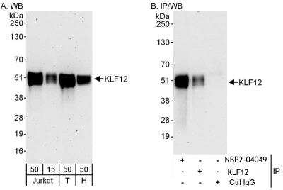 Immunoprecipitation: KLF12 Antibody [NBP2-04049] - Samples:  Whole cell lysate from Jurkat (15 and 50 ug for WB; 1 mg for IP, 20% of IP loaded), 293T (T; 50 ug) and HeLa (H; 50 ug) cells.  Antibodies: Affinity purified rabbit anti-KLF12 antibody NBP2-04049 used for WB at 0.1 ug/ml (A) and 0.4 ug/ml (B) and used for IP at 6 ug/mg lysate.  KLF12 was also immunoprecipitated by rabbit anti-KLF12 antibody, which recognizes a downstream epitope.  Detection: Chemiluminescence with exposure times of 3 minutes (A) and 30 seconds (B).