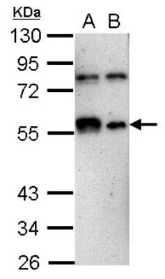 Western Blot: KLF12 Antibody [NBP2-17068] - Sample (30 ug of whole cell lysate) A: THP-1 B: HL-60 10% SDS PAGE gel, diluted at 1:1000.