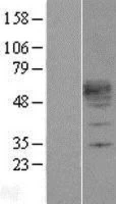 Western Blot: KLF12 Overexpression Lysate (Adult Normal) [NBP2-04324] Left-Empty vector transfected control cell lysate (HEK293 cell lysate); Right -Over-expression Lysate for KLF12.