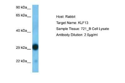 Western Blot: KLF13 Antibody [NBP2-82267] - Host: Rabbit. Target Name: KLF13. Sample Type: 721_B Whole Cell. Antibody Dilution: 1.0ug/ml