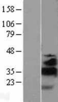 Western Blot KLF13 Overexpression Lysate