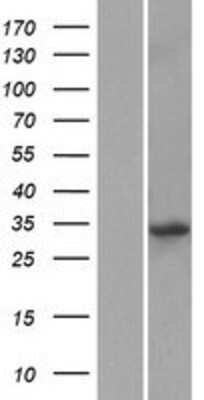 Western Blot: KLF14 Overexpression Lysate (Adult Normal) [NBP2-05638] Left-Empty vector transfected control cell lysate (HEK293 cell lysate); Right -Over-expression Lysate for KLF14.