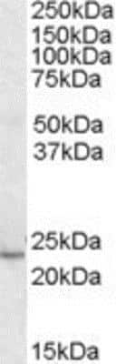 Western Blot KLF16 Antibody
