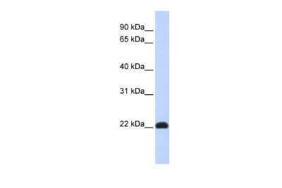 Western Blot: KLF16 Antibody [NBP3-10521] - Western blot analysis using NBP3-10521 on Human Muscle  as a positive control. Antibody Titration: 0.2-1 ug/ml