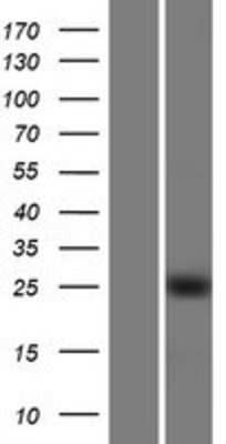 Western Blot KLF16 Overexpression Lysate