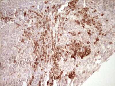 Immunohistochemistry-Paraffin: KLF2 Antibody (OTI3A10) [NBP2-45510] - KLF2 Antibody (3A10) [NBP2-45510] - Analysis of Human tonsil tissue. (Heat-induced epitope retrieval by 1 mM EDTA in 10mM Tris, pH8.5, 120C for 3min)