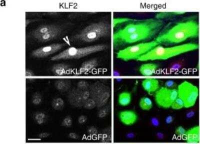 Immunocytochemistry/Immunofluorescence: KLF2 Antibody [NB100-1051] - Expression of KLF2 in cells infected with AdGFP and AdKLF2-GFP (24h). Infected cells are green and the arrowhead points to nuclear localisation of KLF2; bar=10um. Image collected and cropped by CiteAb from the following publication (nature.com/articles/s41467-020-14966-x), licensed under a CC-BY license.
