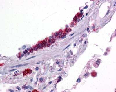 Immunohistochemistry: KLF2 Antibody [NBP3-10956] - Immunohistochemical analysis of human lung