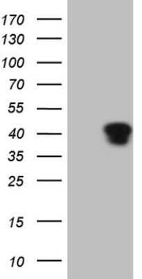 Western Blot: KLF2 Antibody (OTI3A10) - Azide and BSA Free [NBP2-71597] - Analysis of HEK293T cells were transfected with the pCMV6-ENTRY control (Left lane) or pCMV6-ENTRY KLF2.