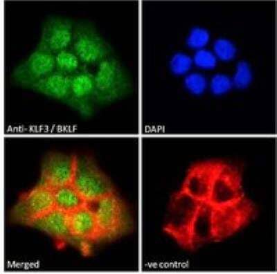 Immunocytochemistry/Immunofluorescence: KLF3 Antibody [NB100-1018] - Immunofluorescence analysis of paraformaldehyde fixed A431 cells, permeabilized with 0.15% Triton. Primary incubation 1hr (10 ug/mL) followed by Alexa Fluor 488 secondary antibody (2 ug/mL), showing nuclear staining. Actin filaments were stained with phalloidin (red) and the nuclear stain is DAPI (blue). Negative control: Unimmunized goat IgG (10 ug/mL) followed by Alexa Fluor 488 secondary antibody (2 ug/mL).