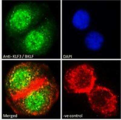 Immunocytochemistry/Immunofluorescence: KLF3 Antibody [NB100-1018] - Immunofluorescence analysis of paraformaldehyde fixed A549 cells, permeabilized with 0.15% Triton. Primary incubation 1hr (10 ug/mL) followed by Alexa Fluor 488 secondary antibody (2 ug/mL), showing nuclear staining. Actin filaments were stained with phalloidin (red) and the nuclear stain is DAPI (blue). Negative control: Unimmunized goat IgG (10 ug/mL) followed by Alexa Fluor 488 secondary antibody (2 ug/mL).