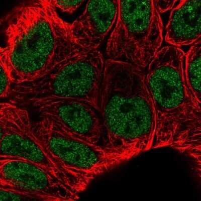 Immunocytochemistry/Immunofluorescence: KLF3 Antibody [NBP2-57746] - Staining of human cell line RT4 shows localization to nucleoplasm.