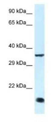 Western Blot: KLF3 Antibody [NBP1-82403] - Rat Muscle Lysate 1ug/ml Gel Concentration 12%