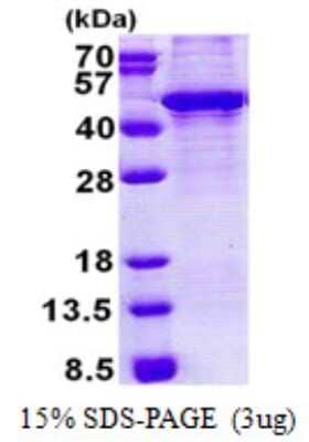 SDS-Page: KLF3 Protein [NBP2-23175]