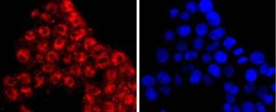 Immunocytochemistry/Immunofluorescence: KLF4 Antibody (JF98-08) [NBP2-66918] - Staining KLF4 in 293T cells (red). The nuclear counter stain is DAPI (blue). Cells were fixed in paraformaldehyde, permeabilised with 0.25% Triton X100/PBS.