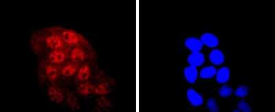 Immunocytochemistry/Immunofluorescence: KLF4 Antibody (JF98-08) [NBP2-66918] - Staining KLF4 in Hela cells (red). The nuclear counter stain is DAPI (blue). Cells were fixed in paraformaldehyde, permeabilised with 0.25% Triton X100/PBS.