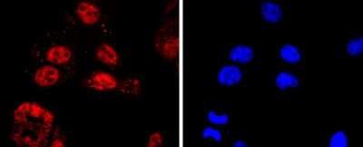 Immunocytochemistry/Immunofluorescence: KLF4 Antibody (JF98-08) [NBP2-66918] - Staining KLF4 in PC-3M cells (red). The nuclear counter stain is DAPI (blue). Cells were fixed in paraformaldehyde, permeabilised with 0.25% Triton X100/PBS.