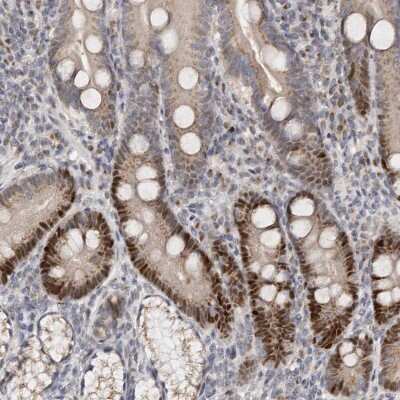 Immunohistochemistry-Paraffin KLF7 Antibody