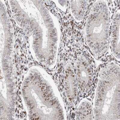 Immunohistochemistry-Paraffin KLF7 Antibody