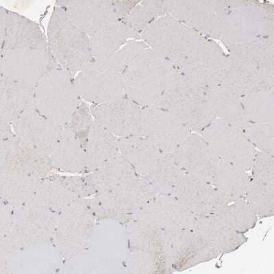 Immunohistochemistry-Paraffin KLF7 Antibody