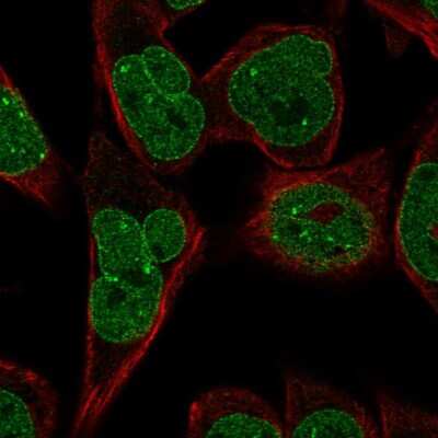 Immunocytochemistry/Immunofluorescence: KLHDC2 Antibody [NBP2-14163] - Immunofluorescent staining of human cell line RH-30 shows localization to nuclear bodies & nuclear membrane.