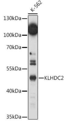 Western Blot: KLHDC2 Antibody [NBP3-04568] - Western blot analysis of extracts of K-562 cells, using KLHDC2 antibody at 1:1000 dilution. Secondary antibody: HRP Goat Anti-Rabbit IgG (H+L) at 1:10000 dilution. Lysates/proteins: 25ug per lane. Blocking buffer: 3% nonfat dry milk in TBST. Detection: ECL Basic Kit. Exposure time: 150s.