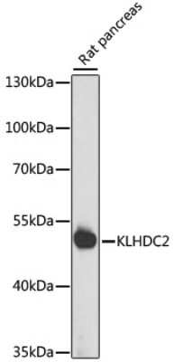 Western Blot: KLHDC2 Antibody [NBP3-04569] - Analysis of extracts of rat pancreas, using KLHDC2 antibody at 1:1000 dilution. Secondary antibody: HRP Goat Anti-Rabbit IgG (H+L) at 1:10000 dilution. Lysates/proteins: 25ug per lane. Blocking buffer: 3% nonfat dry milk in TBST. Detection: ECL Basic Kit
