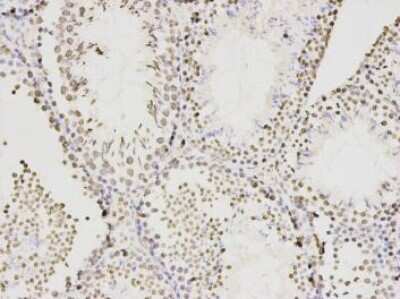 Immunohistochemistry-Paraffin: KLHDC3 Antibody (A8-E8) [NBP2-66919] - Analysis of paraffin-embedded mouse testis tissue using anti- KLHDC3 mouse mAb.