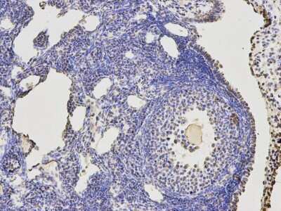 Immunohistochemistry-Paraffin: KLHDC3 Antibody (A8-E8) [NBP2-66919] - Analysis of paraffin-embedded mouse ovary tissue using anti- KLHDC3 mouse mAb.