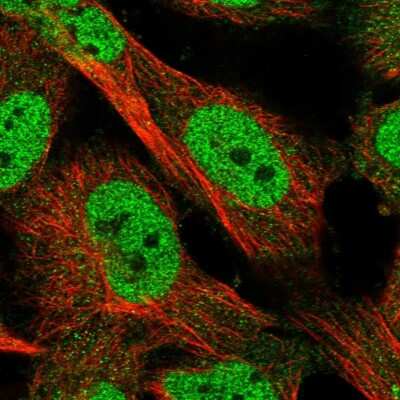 Immunocytochemistry/Immunofluorescence: KLHDC3 Antibody [NBP1-85196] - Immunofluorescent staining of human cell line U-251 MG shows localization to nucleoplasm.