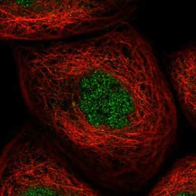 Immunocytochemistry/ Immunofluorescence KLHDC3 Antibody - BSA Free