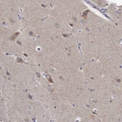 Immunohistochemistry-Paraffin: KLHDC3 Antibody [NBP1-85195] - Staining of human cerebral cortex shows moderate cytoplasmic positivity in neuronal cells.