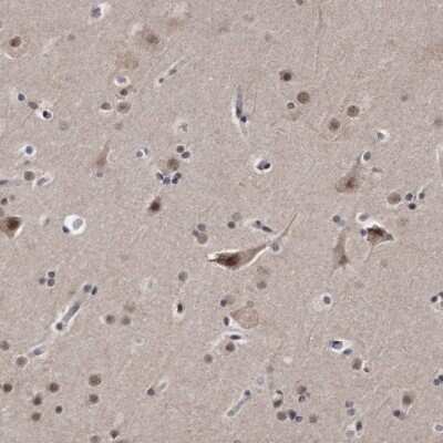 Immunohistochemistry-Paraffin: KLHDC3 Antibody [NBP1-85196] - Staining of human cerebral cortex shows moderate nuclear and cytoplasmic positivity in neuronal cells.