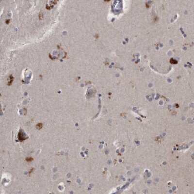 Immunohistochemistry-Paraffin: KLHDC3 Antibody [NBP1-85197] - Staining of human cerebral cortex shows strong cytoplasmic positivity in subsets of neuronal cells.