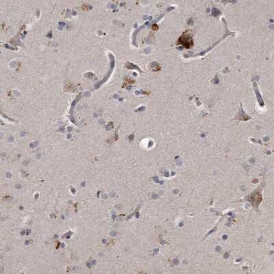 Immunohistochemistry-Paraffin: KLHDC3 Antibody [NBP1-85198] - Staining of human cerebral cortex shows strong cytoplasmic positivity in neuronal cells.