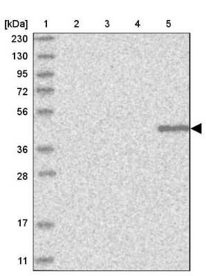 Western Blot KLHDC3 Antibody - BSA Free